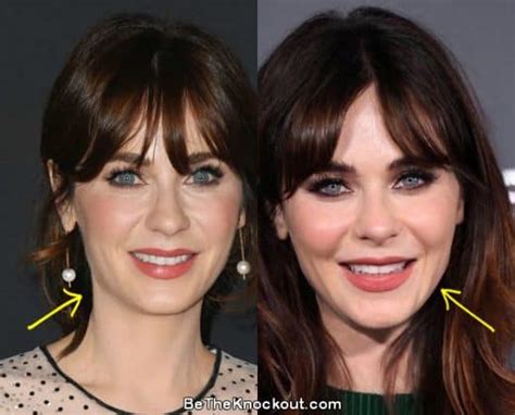 zooey deschanel facelift|Zooey Deschanel Plastic Surgery: Has the Actress Had Work Done